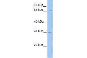 WB Suggested Anti-NR1D2 Antibody Titration:  0. (NR1D2 抗体  (N-Term))