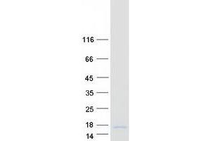 Validation with Western Blot (BLCAP Protein (Myc-DYKDDDDK Tag))