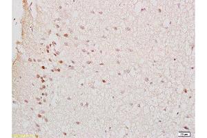 Formalin-fixed and rat brain tissue labeled with Anti-GTPBP10 Polyclonal Antibody , Unconjugated at 1:200 followed by conjugation to the secondary antibody and DAB staining (GTPBP10 抗体  (AA 151-250))