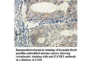 Image no. 1 for anti-Fibronectin Type III and Ankyrin Repeat Domains 1 (FANK1) antibody (ABIN1576454) (FANK1 抗体)