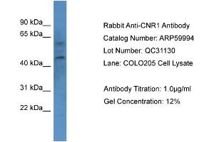 Western Blotting (WB) image for anti-Cannabinoid Receptor 1 (CNR1) (N-Term) antibody (ABIN786077) (CNR1 抗体  (N-Term))
