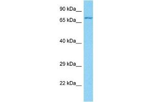 Host:  Rabbit  Target Name:  GP1BA  Sample Tissue:  Human 786-0 Whole Cell  Antibody Dilution:  1ug/ml (CD42b 抗体  (C-Term))