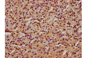 IHC image of ABIN7151301 diluted at 1:600 and staining in paraffin-embedded human adrenal gland tissue performed on a Leica BondTM system. (Zinc Finger Protein 650 (ZNF650) (AA 960-1113) 抗体)