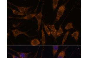 Immunofluorescence analysis of L929 cells using STAR Polyclonal Antibody at dilution of 1:100 (40x lens). (STAR 抗体)