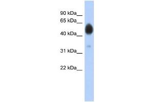 WB Suggested Anti-ARSA Antibody Titration: 0. (Arylsulfatase A 抗体  (N-Term))