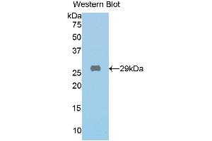 Western blot analysis of the recombinant protein. (GLB1 抗体  (AA 192-432))