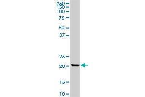 CLTB MaxPab polyclonal antibody. (CLTB 抗体  (AA 1-211))
