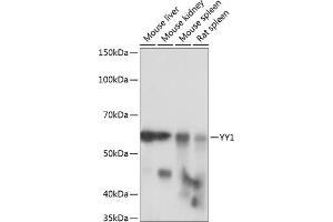 Western blot analysis of extracts of various cell lines, using YY1 antibody (ABIN7271428) at 1:1000 dilution. (YY1 抗体)