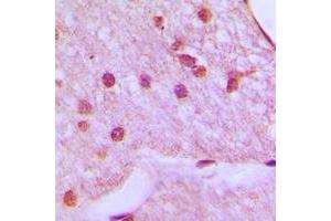 Immunohistochemical analysis of HOXA1 staining in human brain formalin fixed paraffin embedded tissue section. (HOXA1 抗体  (Center))