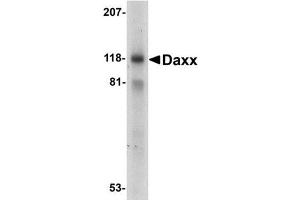 Western blot analysis of Daxx in 293 total cell lysate with AP30275PU-N Dax antibody at 1 mg/ml. (DAXX 抗体  (C-Term))