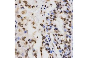 Immunohistochemistry (IHC) image for anti-Histone 3 (H3) (H3K9me3) antibody (ABIN3016030) (Histone 3 抗体  (H3K9me3))