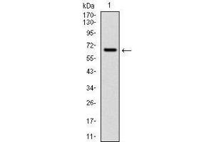 Western Blotting (WB) image for anti-Cytochrome P450, Family 1, Subfamily A, Polypeptide 1 (CYP1A1) antibody (ABIN1106884)