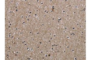 The image on the left is immunohistochemistry of paraffin-embedded Human brain tissue using ABIN7130674(PPAT Antibody) at dilution 1/50, on the right is treated with fusion protein. (PPAT 抗体)