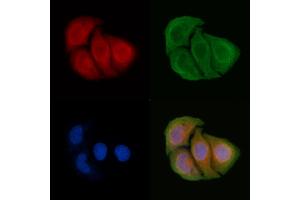 ABIN6265700 and ABIN6266665 staining Hela cells by IF/ICC. (TRADD 抗体  (N-Term))
