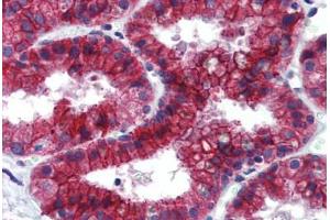 Human Prostate: Formalin-Fixed, Paraffin-Embedded (FFPE) (KDM4C 抗体  (C-Term))
