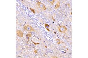 Immunohistochemistry of paraffin embedded rat epencephalon using CRMP3 (ABIN7073734) at dilution of 1:650 (400x lens) (DPYSL4 抗体)