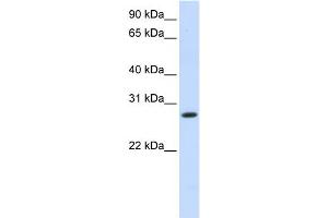 WB Suggested Anti-HSD11B1 Antibody Titration:  1 ug/ml  Positive Control:  Fetal liver cell lysate