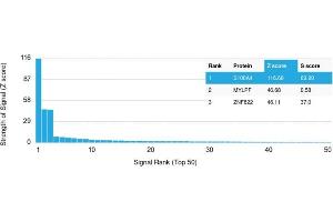 Analysis of Protein Array containing more than 19,000 full-length human proteins using S100A4 Mouse Monoclonal Antibody (CPTC-S100A4-3). (s100a4 抗体)