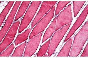 Human Skeletal Muscle: Formalin-Fixed, Paraffin-Embedded (FFPE) (CA3 抗体  (AA 1-261))