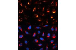 Immunofluorescence analysis of U2OS cells using Cytokeratin 18 (KRT18) antibody (ABIN7268098) at dilution of 1:100. (Cytokeratin 18 抗体  (AA 127-430))