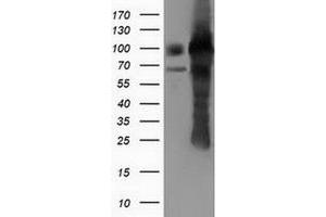 Western Blotting (WB) image for anti-Pseudouridylate Synthase 7 Homolog (PUS7) antibody (ABIN1500514) (PUS7 抗体)