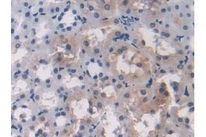 Immunohistochemistry (IHC) image for anti-2',5'-Oligoadenylate Synthetase 1, 40/46kDa (OAS1) (AA 139-358) antibody (ABIN7435082)