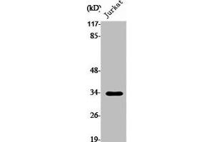 Western Blot analysis of Jurkat cells using Pitx1 Polyclonal Antibody (PITX1 抗体  (Internal Region))