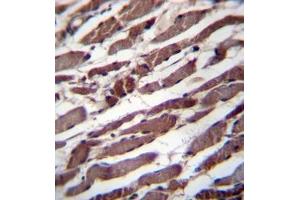 Formalin fixed, paraffin embedded human skeletal muscle stained with PUS1 Antibody (C-term) followed by peroxidase conjugation of the secondary antibody and DAB staining (PUS1 抗体  (C-Term))