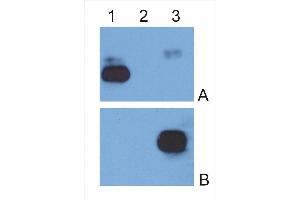 IgG κ light chain (1), IgG λ light chain (2) and IgG Fc fragment (3) purified from human serum were analysed by Western blotting with MEM-09 antibody against IgG κ light chain (A) and EM-07 antibody against IgG Fc fragment (B). (小鼠 anti-人 IgG Fc (Fc Region) Antibody (FITC))