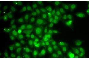 Immunofluorescence analysis of A549 cells using TRAF4 Polyclonal Antibody (TRAF4 抗体)