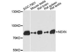 Western blot analysis of extracts of various cell lines, using NEXN antibody. (NEXN 抗体  (AA 516-675))