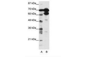 Image no. 1 for anti-Zinc Finger Protein 76 (Expressed in Testis) (ZNF76) (N-Term) antibody (ABIN202772) (ZNF76 抗体  (N-Term))