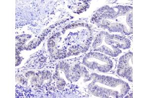 IHC analysis of Hsp105 using anti-Hsp105 antibody (ABIN5693036). (HSPH1 抗体  (AA 653-858))