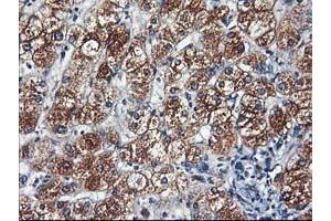 Immunohistochemical staining of paraffin-embedded Human liver tissue using anti-HARS2 mouse monoclonal antibody. (HARS2 抗体)