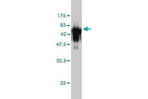 Western Blotting (WB) image for anti-Acid Phosphatase 2, Lysosomal (ACP2) (AA 1-423) antibody (ABIN559751)
