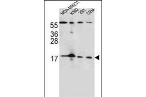 FGF22 Antibody (N-term) (ABIN656125 and ABIN2845466) western blot analysis in MDA-M,K562,293,CEM cell line lysates (35 μg/lane). (FGF22 抗体  (N-Term))