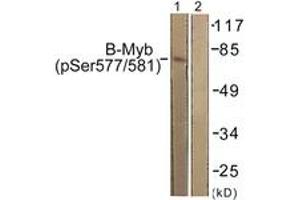Western Blotting (WB) image for anti-V-Myb Myeloblastosis Viral Oncogene Homolog (Avian)-Like 2 (MYBL2) (AA 551-600), (pSer577) antibody (ABIN1531525)