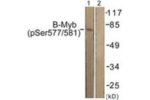 Western blot analysis of extracts from K562 cells, using B-Myb (Phospho-Ser577/581) Antibody. (MYBL2 抗体  (pSer577))