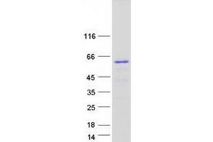 Western Blotting (WB) image for Spastin (SPAST) (Transcript Variant 2) protein (Myc-DYKDDDDK Tag) (ABIN2732511)