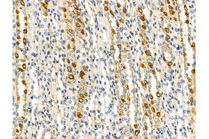 ABIN6263559 and ABIN6268825 at 1/100 staining Rat kidney tissue by IHC-P. (NDUFA4 抗体  (C-Term))