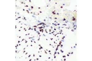 Immunohistochemical analysis of SHARP-2 staining in mouse lung formalin fixed paraffin embedded tissue section. (BHLHE40 抗体)
