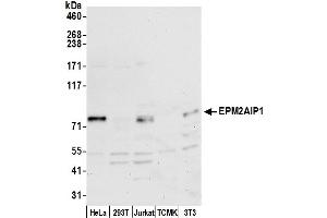 Western Blotting (WB) image for anti-EPM2A (Laforin) Interacting Protein 1 (EPM2AIP1) (AA 100-150) antibody (ABIN7452604)