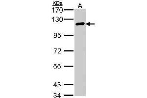 Western Blotting (WB) image for anti-Cylindromatosis (Turban Tumor Syndrome) (CYLD) (C-Term) antibody (ABIN2854660)