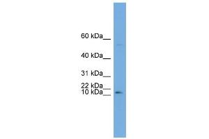 WB Suggested Anti-ATP6V0C Antibody Titration:  0. (ATP6V0C 抗体  (Middle Region))