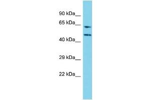 Host: Rabbit Target Name: WDR85 Sample Type: Jurkat Whole Cell lysates Antibody Dilution: 1. (Diphthamide Biosynthesis 7 (DPH7) (N-Term) 抗体)