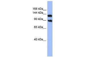 WB Suggested Anti-KCNH3 Antibody Titration:  0. (KCNH3 抗体  (Middle Region))