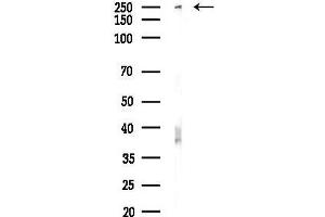 anti-WNK Lysine Deficient Protein Kinase 1 (WNK1) (N-Term) antibody