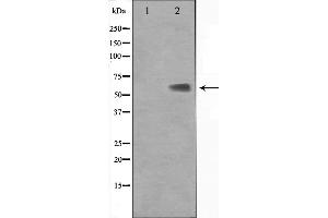 Western blot analysis on Jurkat cell lysate using KLF11 Antibody. (KLF11 抗体  (N-Term))