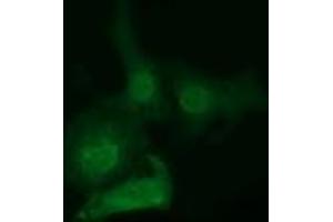 Immunofluorescence (IF) image for anti-EPM2A (Laforin) Interacting Protein 1 (EPM2AIP1) antibody (ABIN1498043) (EPM2AIP1 抗体)