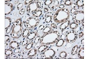 Immunohistochemical staining of paraffin-embedded Human Kidney tissue using anti-TBXAS1 mouse monoclonal antibody. (TBXAS1 抗体)